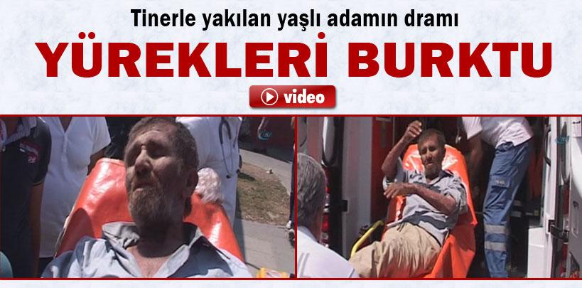 Tinerle yakılan yaşlı adamın dramı yürekleri burktu