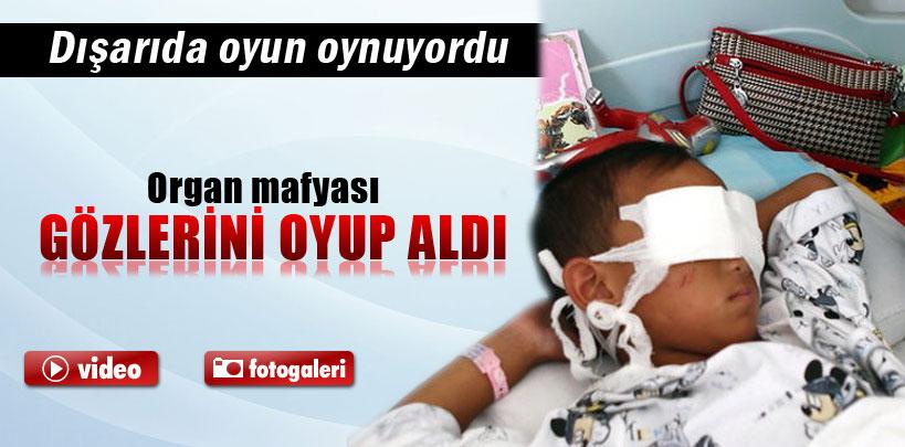 Organ tacirleri çocuğu kaçırıp gözlerini oydu