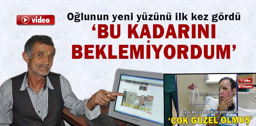 Recep Sert'in babası oğlunun yeni yüzünü ilk kez gördü