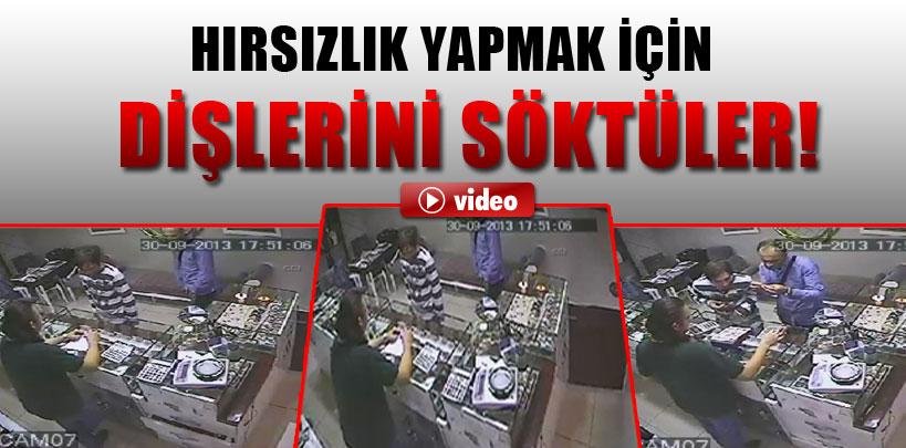 İstanbul'da, hırsızlık yapmak için ön dişlerini söktüler