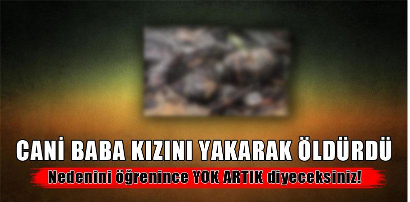 Yemenli kız babası tarafından yakılarak öldürüldü