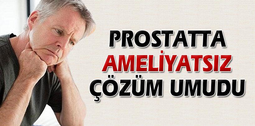 Prostatta ameliyatsız çözüm umudu